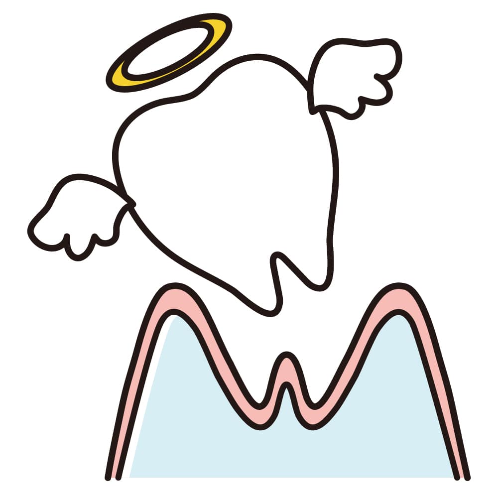 ピクシカ　抜歯　イラスト