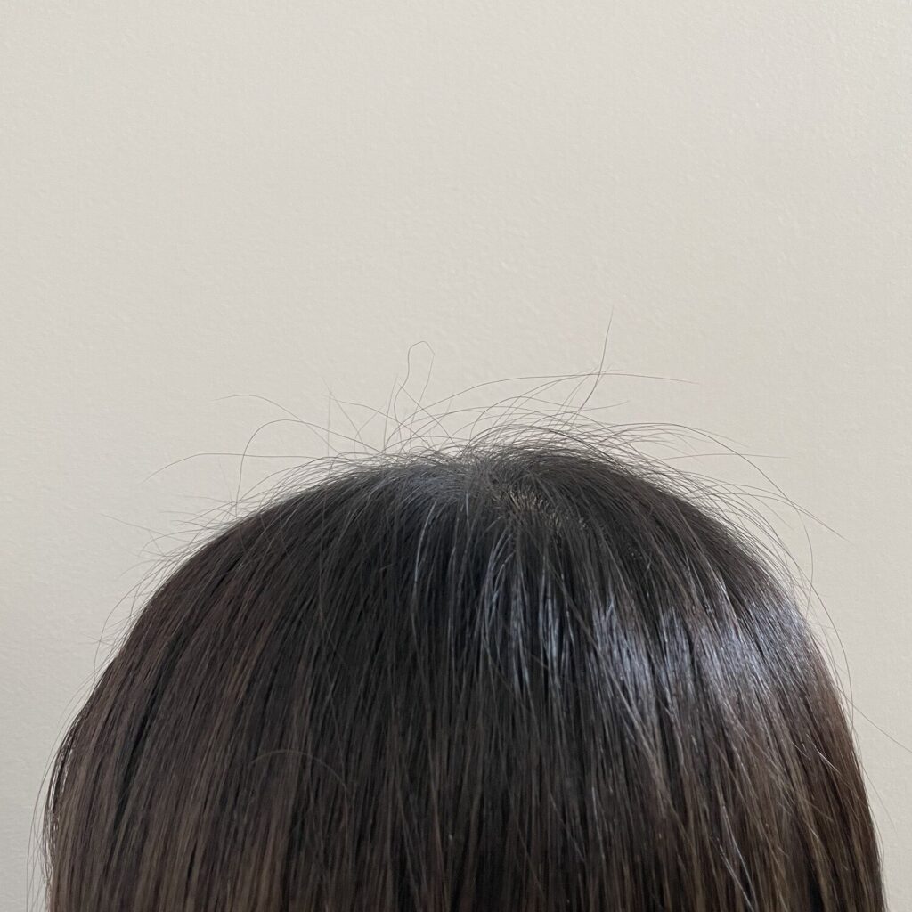 Mieu Mieu(ミュミュ) エスティック 使用前