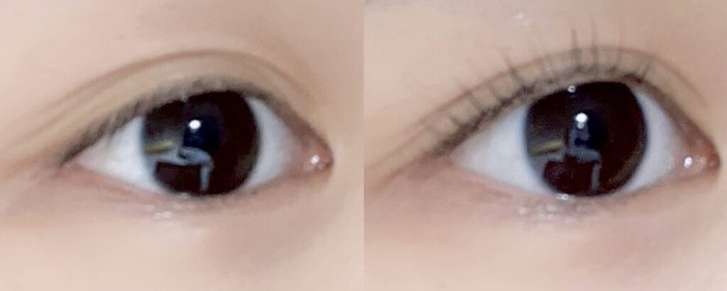 施術前後のビフォアフ