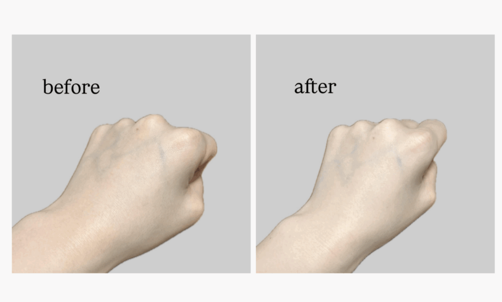 before&after