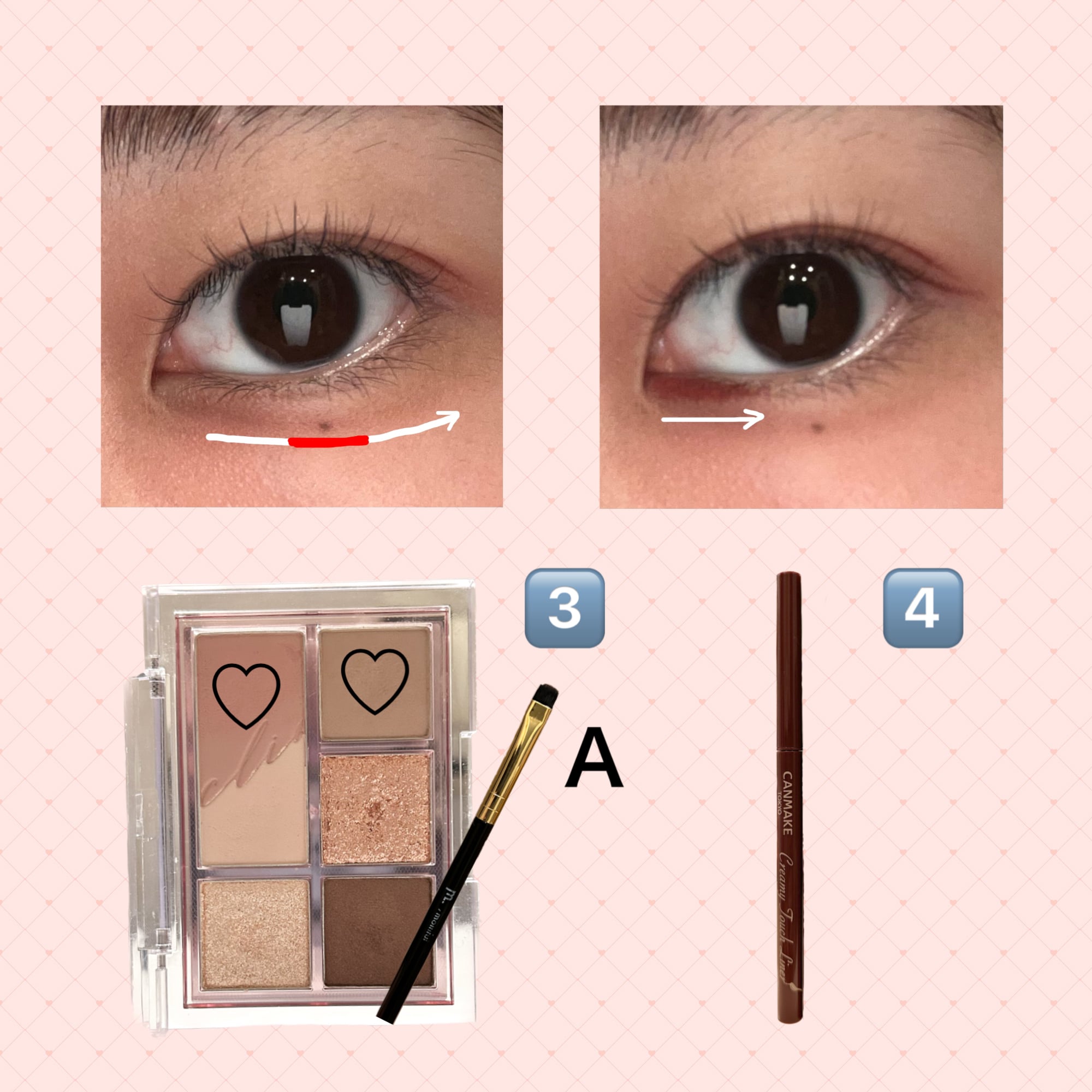 涙袋の影→粘膜偽造ラインの解説画像