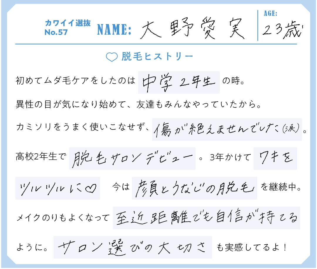 カワイイ選抜 No.57 大野愛実さんの大学生のための脱毛ヒストリー2-2