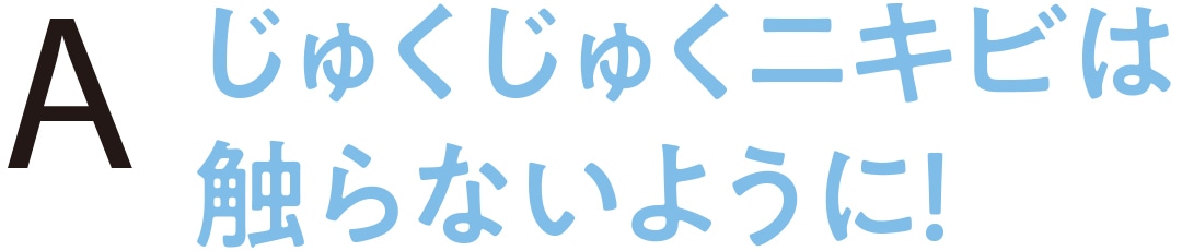 じゅくじゅくニキビは触らないように！