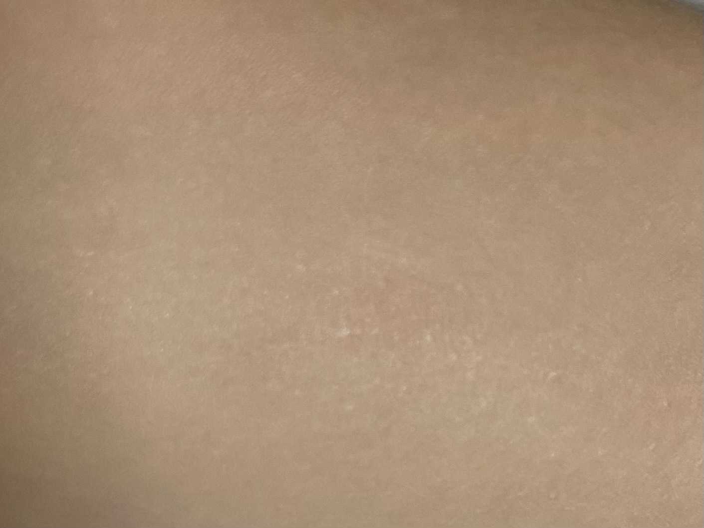 シカペアリカバー　カバー力検証　リップ